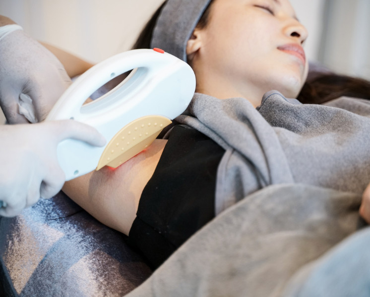Trị Thâm Nách Tại Sen Beauty